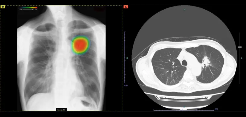 胸部の画像診断 Thoracic Imaging 胸部の画像診断 Thoracic Imaging 健康・医学